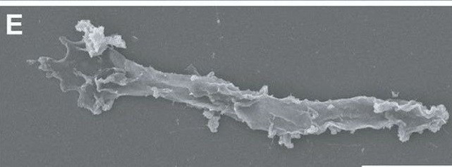 Thậm chí ở mức nhiệt 70 độ C, Incendiamoeba cascadensis còn có thể hình thành các "nang" ngủ đông, có khả năng tái hoạt động khi nhiệt độ giảm xuống. Ảnh: Rappaport et al., bioRxiv, 2025.