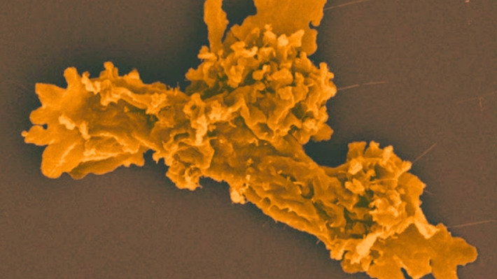 Nhà vi sinh vật học Oliverio VÀ đồng nghiệp là Beryl Rappaport đã phát hiện ra sinh vật này tại Công viên Quốc gia Núi lửa Lassen (California, Mỹ). Họ đặt tên cho nó là Incendiamoeba cascadensis (tạm dịch là "amip lửa từ vùng Cascades"). Ảnh: Rappaport et al., bioRxiv, 2025.