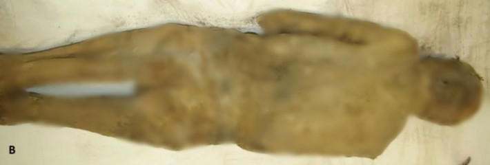 Theo kết quả nghiên cứu ban đầu, các chuyên gia nhận định thi hài vẹn nguyên trên có thể thuộc về một giáo sĩ thế kỷ 18. Gần đây, các chuyên gia đã sử dụng các công nghệ, kỹ thuật hiện đại, bao gồm chụp cắt lớp vi tính (chụp CT), phân tích mẫu xương và mô, xác định niên đại bằng phương pháp carbon phóng xạ. Ảnh: Andreas Nerlich.