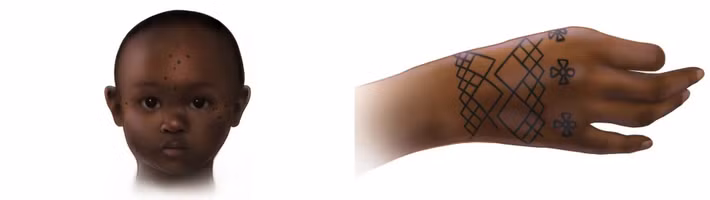 Ngoài ra, một giả thuyết khác cho rằng, việc xăm hình cho những đứa trẻ có thể vì mục đích y tế nhằm giúp chúng xoa dịu cơn đau đầu hoặc sốt. Ảnh: Mary Nguyen/UMSL.