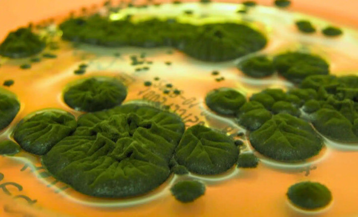 Gần đây, các nhà nghiên cứu tại Đại học Stanford đã tiến hành các thí nghiệm bức xạ đối với Cladosporium sphaerospermum. Theo đó, họ ghi nhận khả năng phát triển trong môi trường bức xạ cao và melanin hoạt động dưới dạng bức xạ ion hóa. Ảnh: Rui Tomé/Atlas of Mycology.