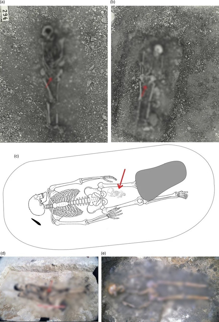 Nhà khảo cổ học Neil Price nhận định ngôi mộ có chứa nhiều đồ tùy táng giá trị cho thấy người phụ nữ được chôn cất tại đó có thể đã giữ vai trò quan trọng trong xã hội Viking khi ấy với tư cách là người thực hành phép thuật hoặc nghi lễ. Ảnh: Kopparsvik / Toplak / Matt Hitchcock.