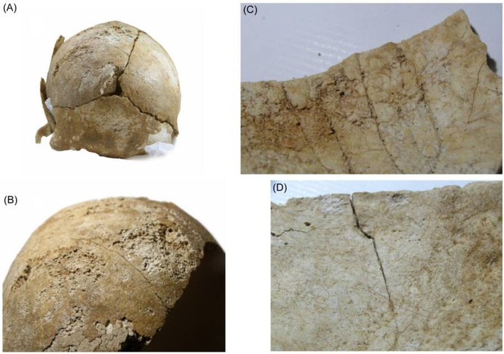 Các nhà nghiên cứu nghi ngờ rằng người đàn ông này đã hy sinh khi bảo vệ pháo đài và người La Mã cố tình đặt hộp sọ của ông lên tường thành sau khi chiếm đóng nơi này. Ảnh: Santiago D. Domínguez-Solera.