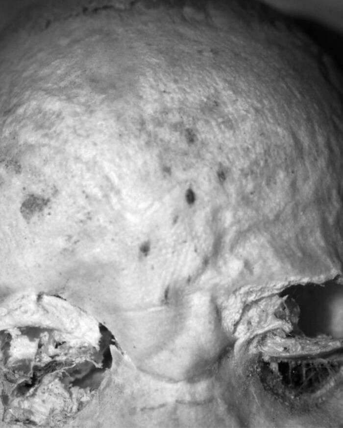 Thông tin này cho thấy tập tục xăm hình trên cơ thể phổ biến hơn nhiều so với hiểu biết trước đây. Trong số những hình xăm được phát hiện trên các bộ hài cốt cổ xưa, các chuyên gia tìm thấy bằng chứng cho thấy trẻ em dưới 3 tuổi cũng thực hiện tập tục này. Ảnh: Austin et al., PNAS (2025).