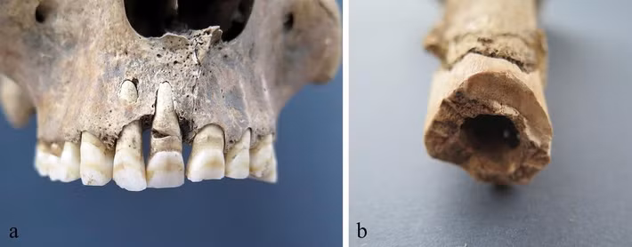 Các chuyên gia đã xác định niên đại bằng phương pháp cacbon của 4 bộ hài cốt vào nửa sau thế kỷ 3 và niên đại này trùng khớp với hiện vật duy nhất được tìm thấy dưới giếng. Đó là một đồng tiền La Mã được đúc vào năm 251. Ảnh: M. Novak et al., PloS One (2025); CC BY 4.0.