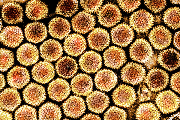 Nguyên nhân gây bệnh viêm gan bí ẩn liệu có liên quan đến COVID-19? Nguyen nhan gay benh viem gan bi an lieu co lien quan den COVID-19?