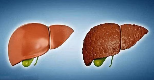 Day la nhung thoi quen hai gan hon ruou manh