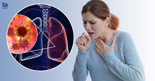 Ngoài khói thuốc lá, còn loạt tác nhân hàng ngày cũng gây ung thư phổi - Hình 9 Ngoai khoi thuoc la, con loat tac nhan hang ngay cung gay ung thu phoi-Hinh-9