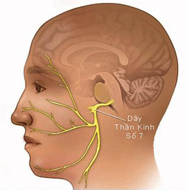 Bật điều hòa cả đêm, chàng trai bị biến dạng gương mặt - Hình 5 Bat dieu hoa ca dem, chang trai bi bien dang guong mat-Hinh-5