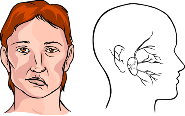 Bật điều hòa cả đêm, chàng trai bị biến dạng gương mặt - Hình 2 Bat dieu hoa ca dem, chang trai bi bien dang guong mat-Hinh-2