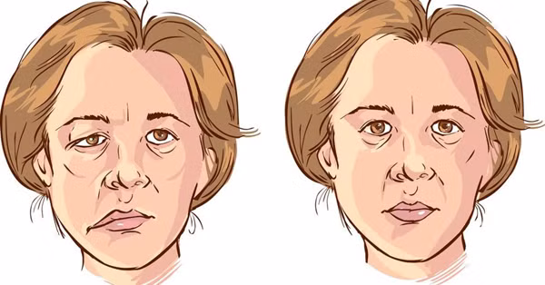 Bat dieu hoa ca dem, chang trai bi bien dang guong mat-Hinh-3