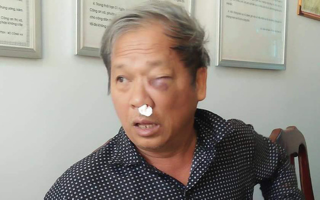 Đọc gì hôm nay 28/1: Đứt lìa tay khi hỗn chiến tại quán cà phê - Hình 2 Doc gi hom nay 28/1: Dut lia tay khi hon chien tai quan ca phe-Hinh-2
