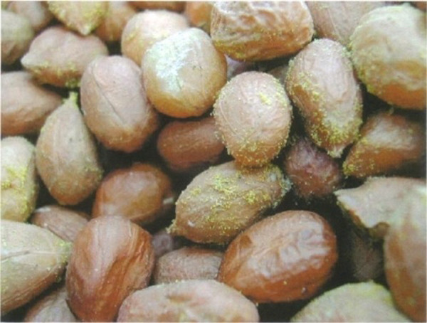 Hai vợ chồng mắc bệnh gan do ăn đậu phộng mốc - Hình 8 Hai vo chong mac benh gan do an dau phong moc-Hinh-8
