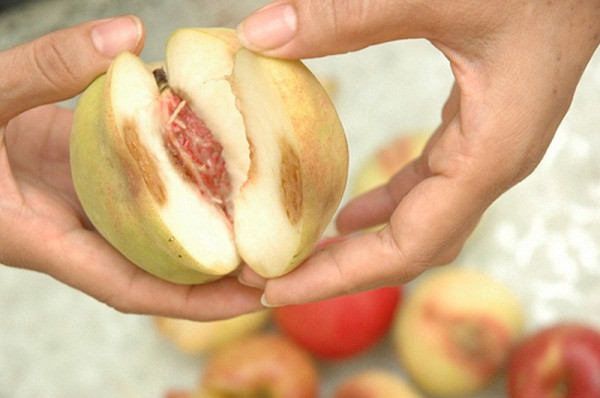 Vợ chồng trẻ mắc ung thư gan nguy hiểm vì tiết kiệm quá mức Vo chong tre mac ung thu gan nguy hiem vi tiet kiem qua muc