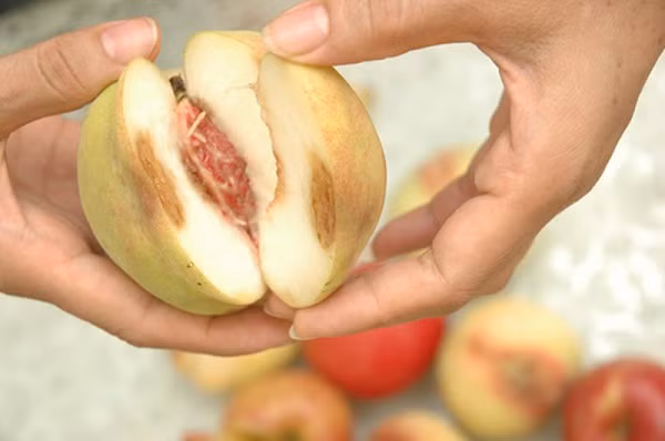 Vo chong tre mac ung thu gan nguy hiem vi tiet kiem qua muc