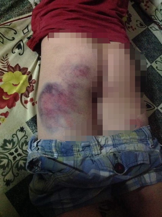 Cô giáo đánh tím mông học sinh lớp 4 vì không biết viết Co giao danh tim mong hoc sinh lop 4 vi khong biet viet