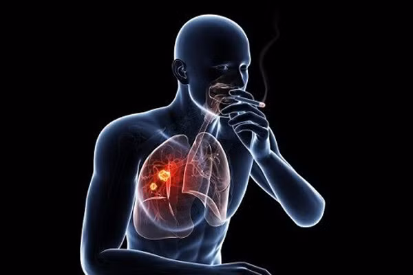 Giat minh loat “benh hon nhan” nguy hiem, chong bi vo cung de mac-Hinh-7