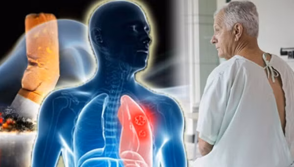 Thoi quen sinh hoat hang ngay khien nam gioi de mac ung thu hon phu nu-Hinh-4