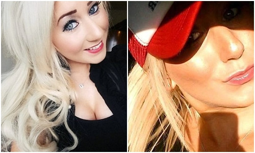 Người mẫu trẻ hỏng môi vì sản phẩm làm đẹp Nguoi mau tre hong moi vi san pham lam dep