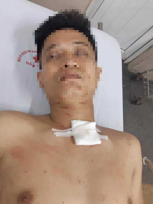 Loạt vụ giết người yêu gây hoang mang dư luận thời gian qua - Hình 2 Loat vu giet nguoi yeu gay hoang mang du luan thoi gian qua-Hinh-2