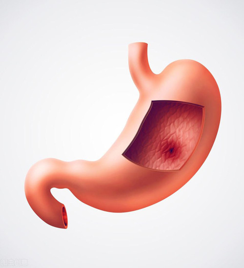 Những vấn đề sức khỏe khiến bạn hôi miệng dù đánh răng kỹ - Hình 6 Nhung van de suc khoe khien ban hoi mieng du danh rang ky-Hinh-6