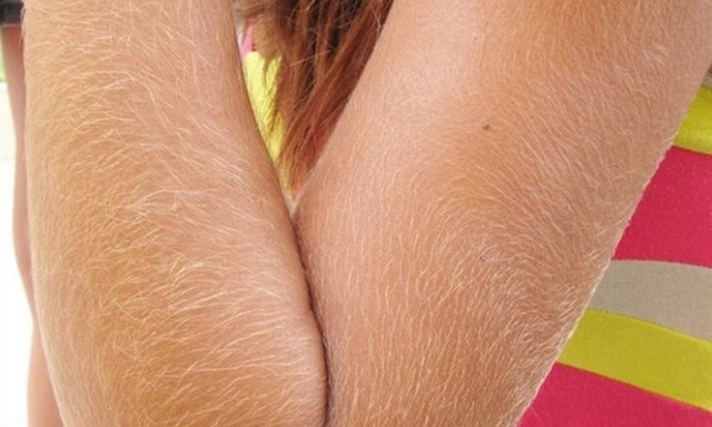 Khám phá 10 bí ẩn trên cơ thể người ít ai biết - Hình 6 Kham pha 10 bi an tren co the nguoi it ai biet-Hinh-6