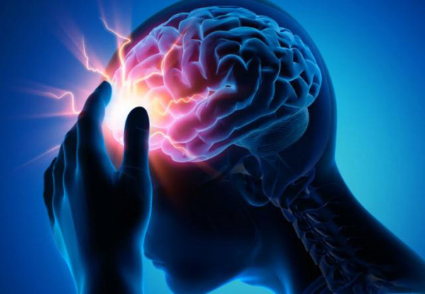 Dấu hiệu đột quỵ cần đi khám '1 tê, 2 đau, 3 không rõ' Dau hieu dot quy can di kham '1 te, 2 dau, 3 khong ro'