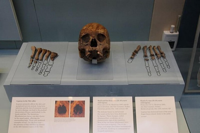 Những bí ẩn chưa có lời giải khiến nhân loại bối rối ở Scotland - Hình 7 Nhung bi an chua co loi giai khien nhan loai boi roi o Scotland-Hinh-7