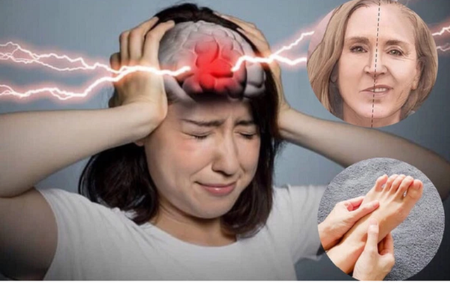 Những tín hiệu cảnh báo xuất huyết não không nên bỏ qua - Hình 2 Nhung tin hieu canh bao xuat huyet nao khong nen bo qua-Hinh-2