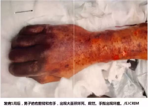 Nguoi dan ong chet tuc tuoi vi... bi cho liem