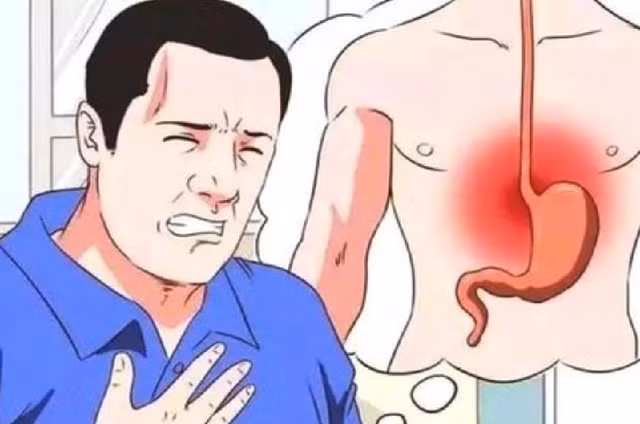 Bac si khuyen 5 dieu cuc don gian giup tranh xa benh trao nguoc da day-Hinh-2