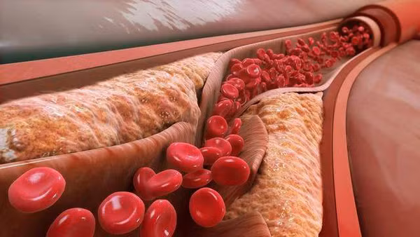 Bat ngo loai rau gay mo mau khong kem thit