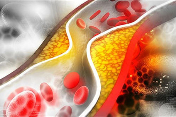 Bất ngờ loại rau gây mỡ máu không kém thịt - Hình 6 Bat ngo loai rau gay mo mau khong kem thit-Hinh-6