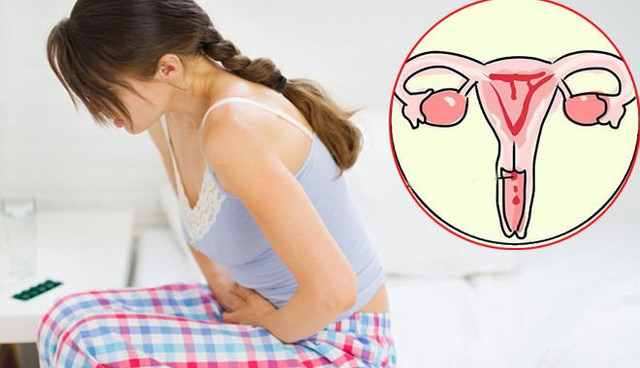 Cảnh báo những dấu hiệu của ung thư cổ tử cung - Hình 7 Canh bao nhung dau hieu cua ung thu co tu cung-Hinh-7