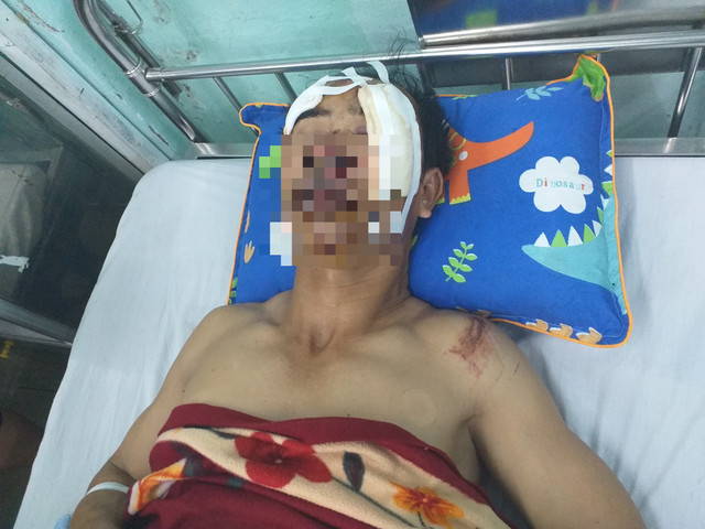 Xe biển xanh gây tai nạn rồi bỏ chạy: nạn nhân vẫn chưa tỉnh lại Xe bien xanh gay tai nan roi bo chay: nan nhan van chua tinh lai