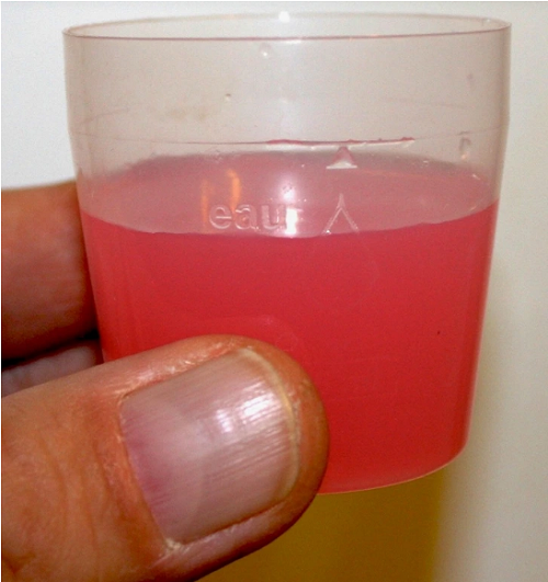 Các thói quen tàn phá cơ thể mỗi ngày Cac thoi quen tan pha co the moi ngay