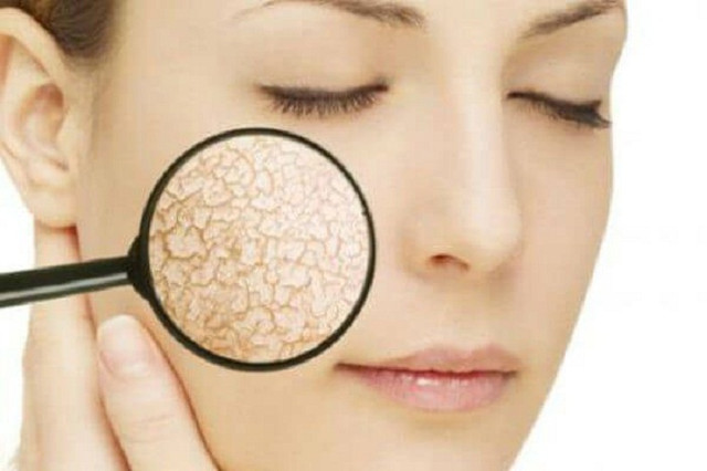 Bi quyet phat hien dau hieu benh than kip thoi-Hinh-8