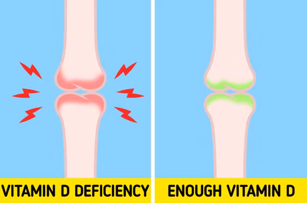 Canh bao lat dau hieu cho thay co the thieu vitamin D tram trong-Hinh-6