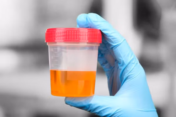 Luu y 3 vi tri “boc mui” chung to gan suy yeu-Hinh-7