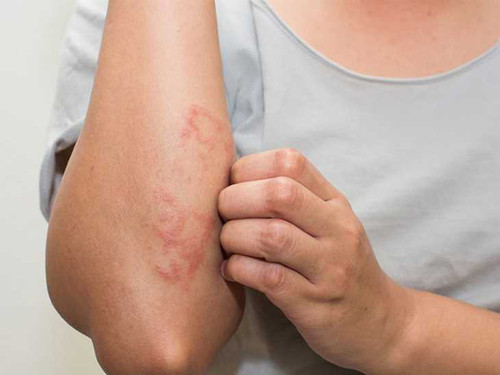 Loạt dấu hiệu bệnh tiểu đường cần chú ý - Hình 8 Loat dau hieu benh tieu duong can chu y-Hinh-8