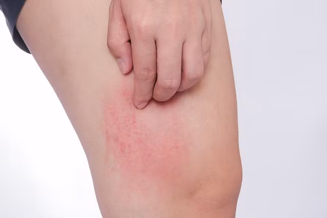 Loat dau hieu benh tieu duong can chu y-Hinh-7