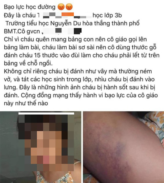 Đắk Lắk: Tin mới nhất vụ cô giáo đánh học sinh lớp 3 tím đùi - Hình 2 Dak Lak: Tin moi nhat vu co giao danh hoc sinh lop 3 tim dui-Hinh-2