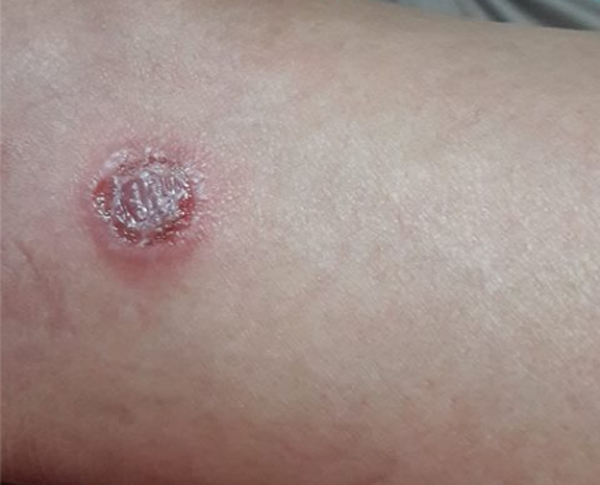 6 dấu hiệu khi hút thuốc cho thấy cơ thể đang gần đến 'cửa tử' - Hình 6 6 dau hieu khi hut thuoc cho thay co the dang gan den 'cua tu'-Hinh-6