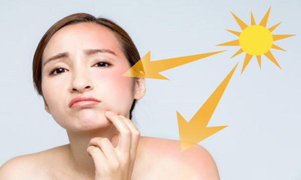 Cách trị mụn thịt tại nhà theo hướng dẫn của chuyên gia - Hình 5 Cach tri mun thit tai nha theo huong dan cua chuyen gia-Hinh-5
