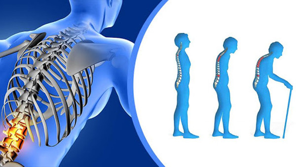 Mướp đắng có lợi cho sức khỏe, nhưng ăn nhiều ảnh hưởng dạ dày và xương - Hình 9 Muop dang co loi cho suc khoe, nhung an nhieu anh huong da day va xuong-Hinh-9
