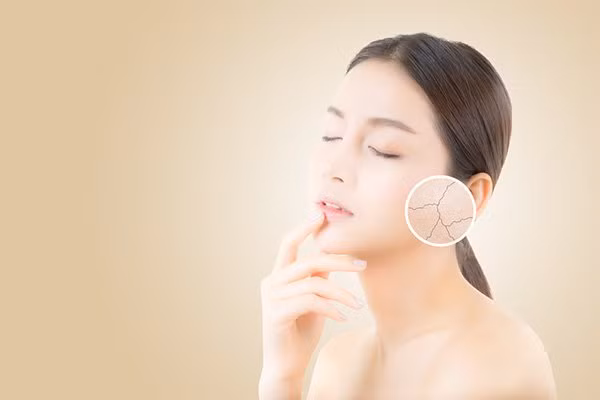 Meo giup tri hoan lao hoa, gin giu tuoi xuan-Hinh-10