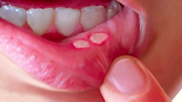 Ăn gừng cả vỏ để nhận tối đa lợi ích? - Hình 6 An gung ca vo de nhan toi da loi ich?-Hinh-6