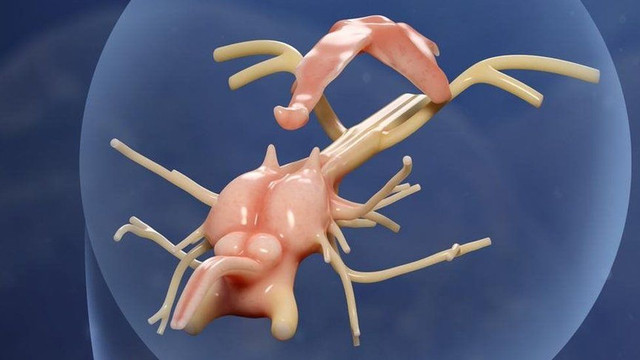 Chuyên gia bối rối khi phát hiện bộ não lâu đời nhất thế giới - Hình 6 Chuyen gia boi roi khi phat hien bo nao lau doi nhat the gioi-Hinh-6