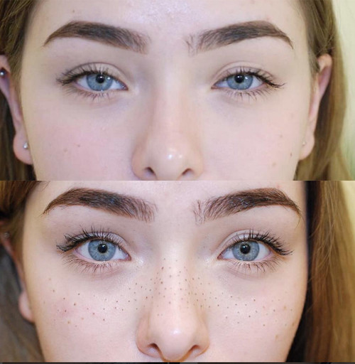 Lại xuất hiện trào lưu xăm tàn nhang ở giới trẻ - Hình 2 Lai xuat hien trao luu xam tan nhang o gioi tre-Hinh-2