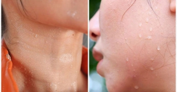 Đổ mồ hôi những vị trí này cảnh giác bệnh tật trong người - Hình 8 Do mo hoi nhung vi tri nay canh giac benh tat trong nguoi-Hinh-8
